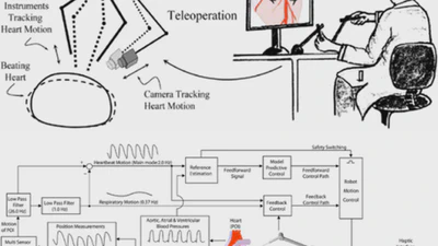 Robotic Beating Heart Surgery featured image